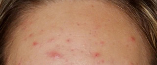 Smoothbeam-Before